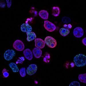 coronavirus malestar psicologico postpandemia