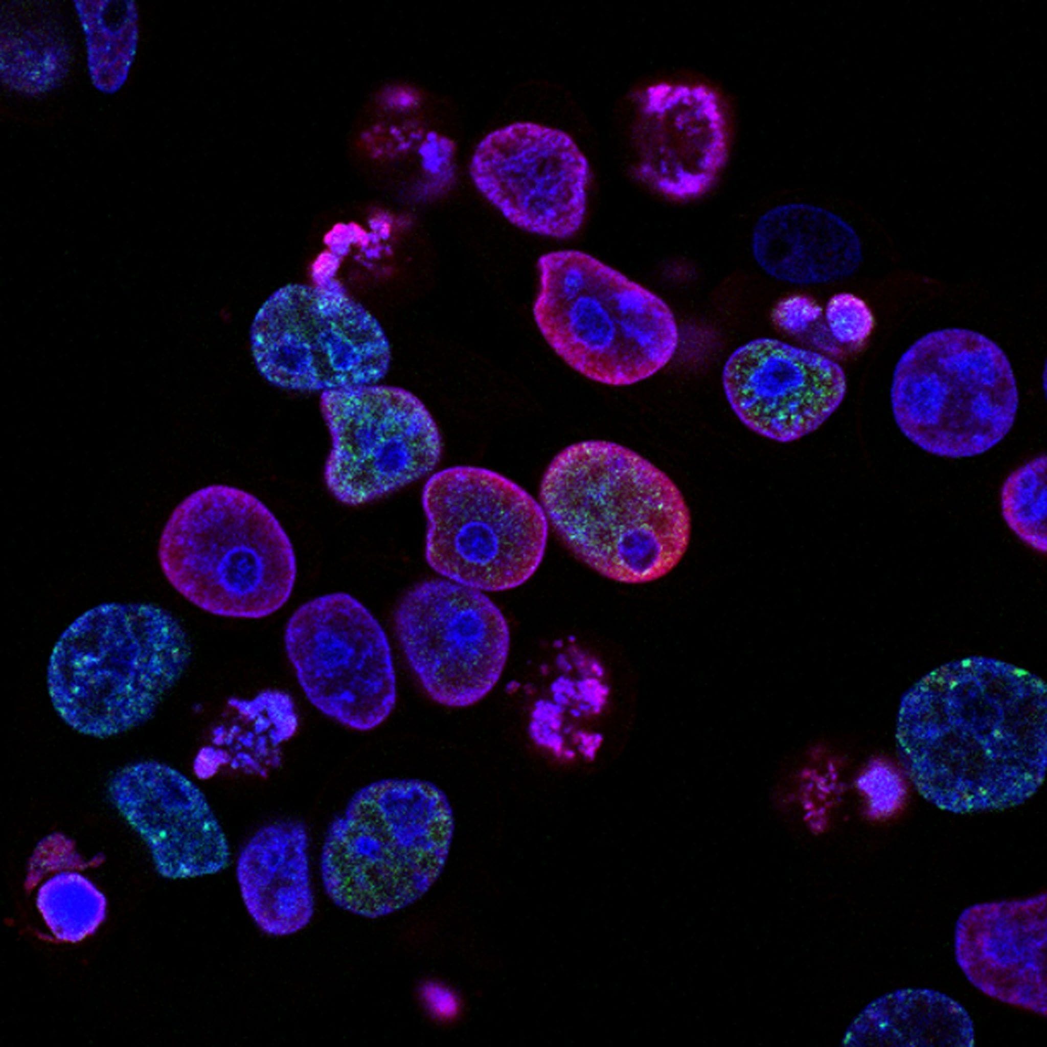 coronavirus malestar psicologico postpandemia